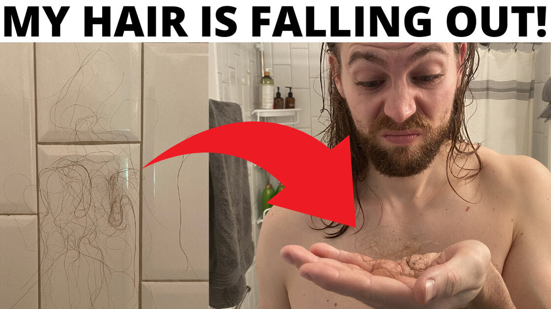 HELP! Am I Balding Or Shedding?