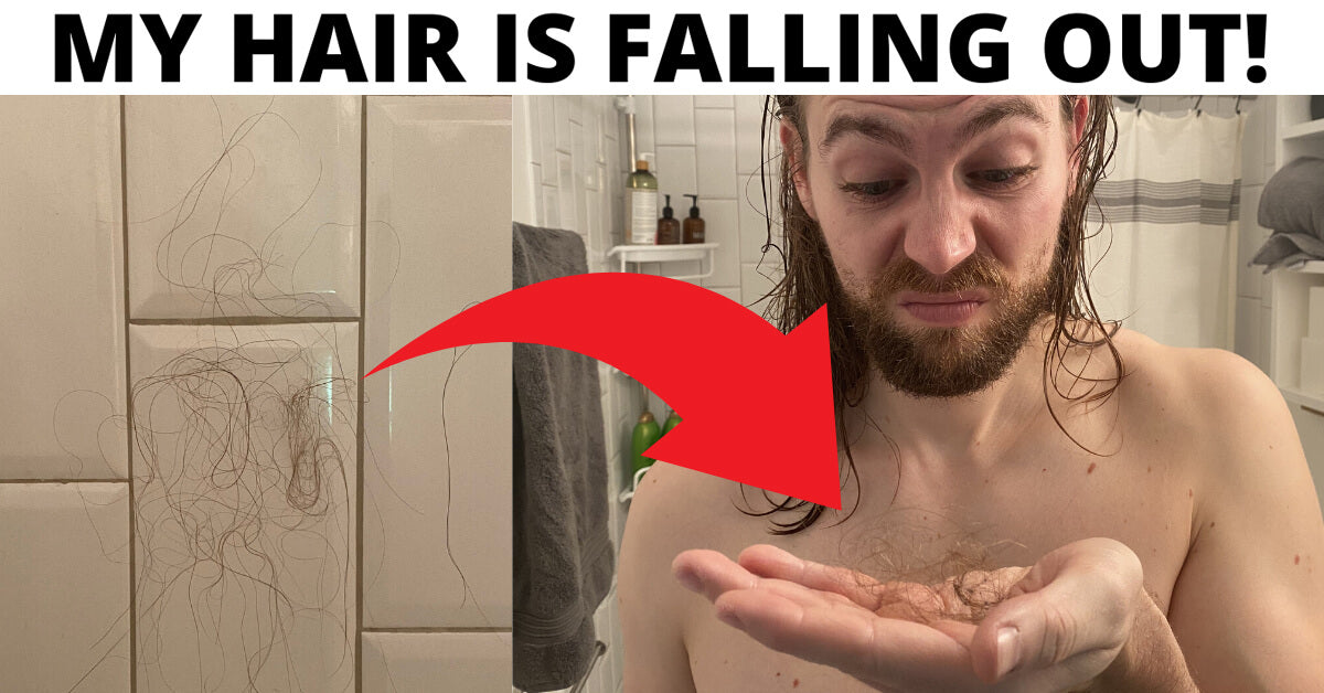 HELP! Am I Balding Or Shedding?